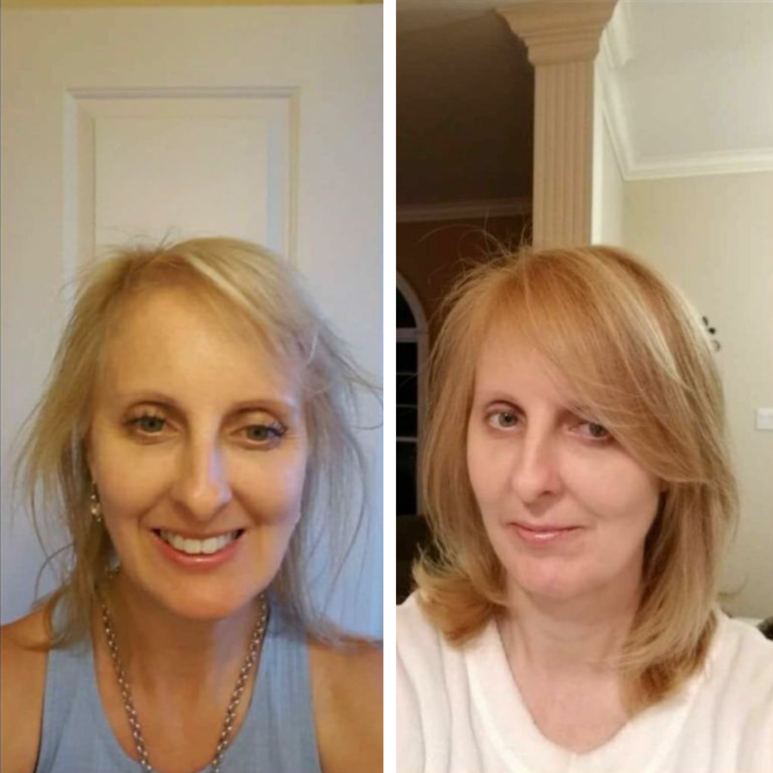 Metia - Follicle Revival Serum