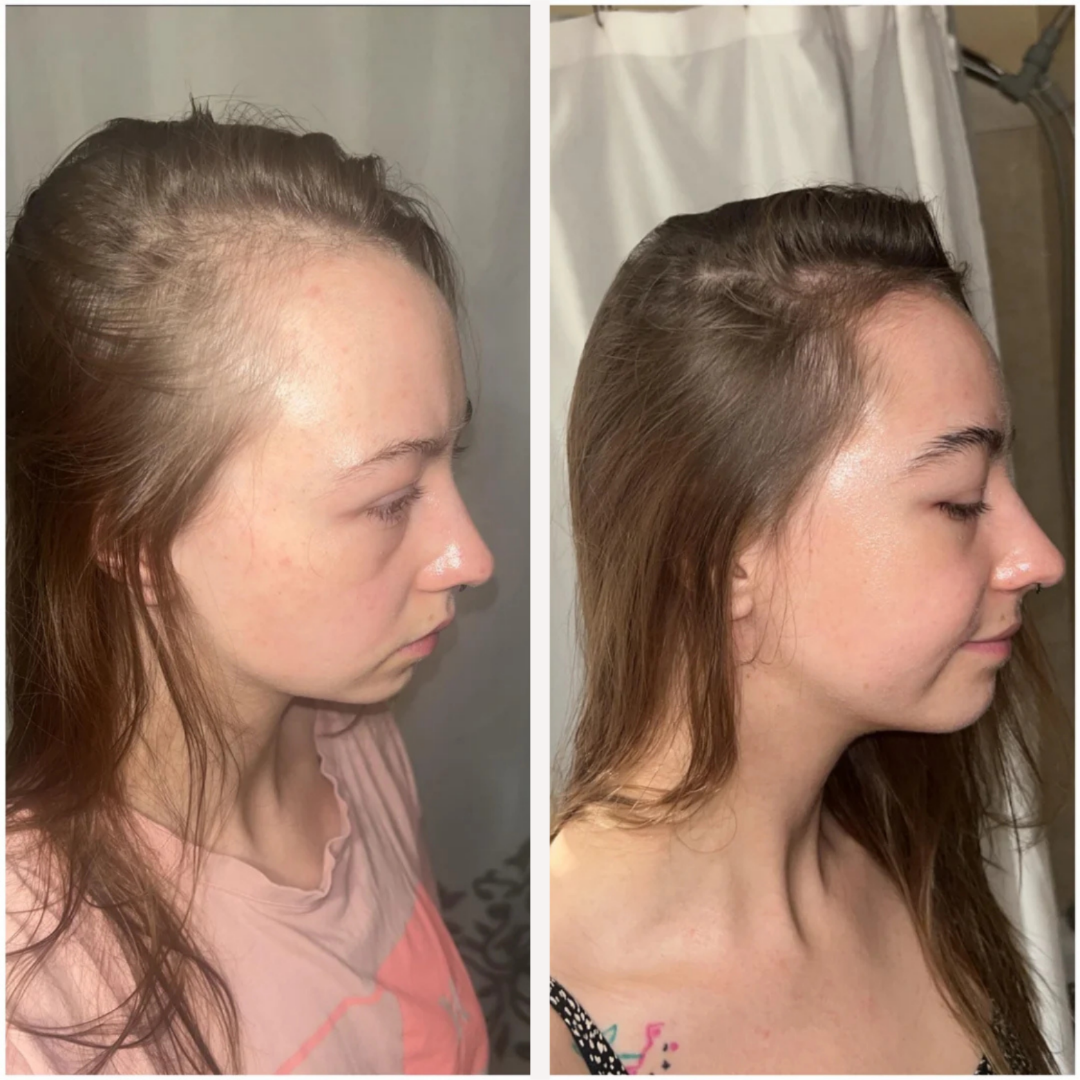 Batana - Hair Growth Oil