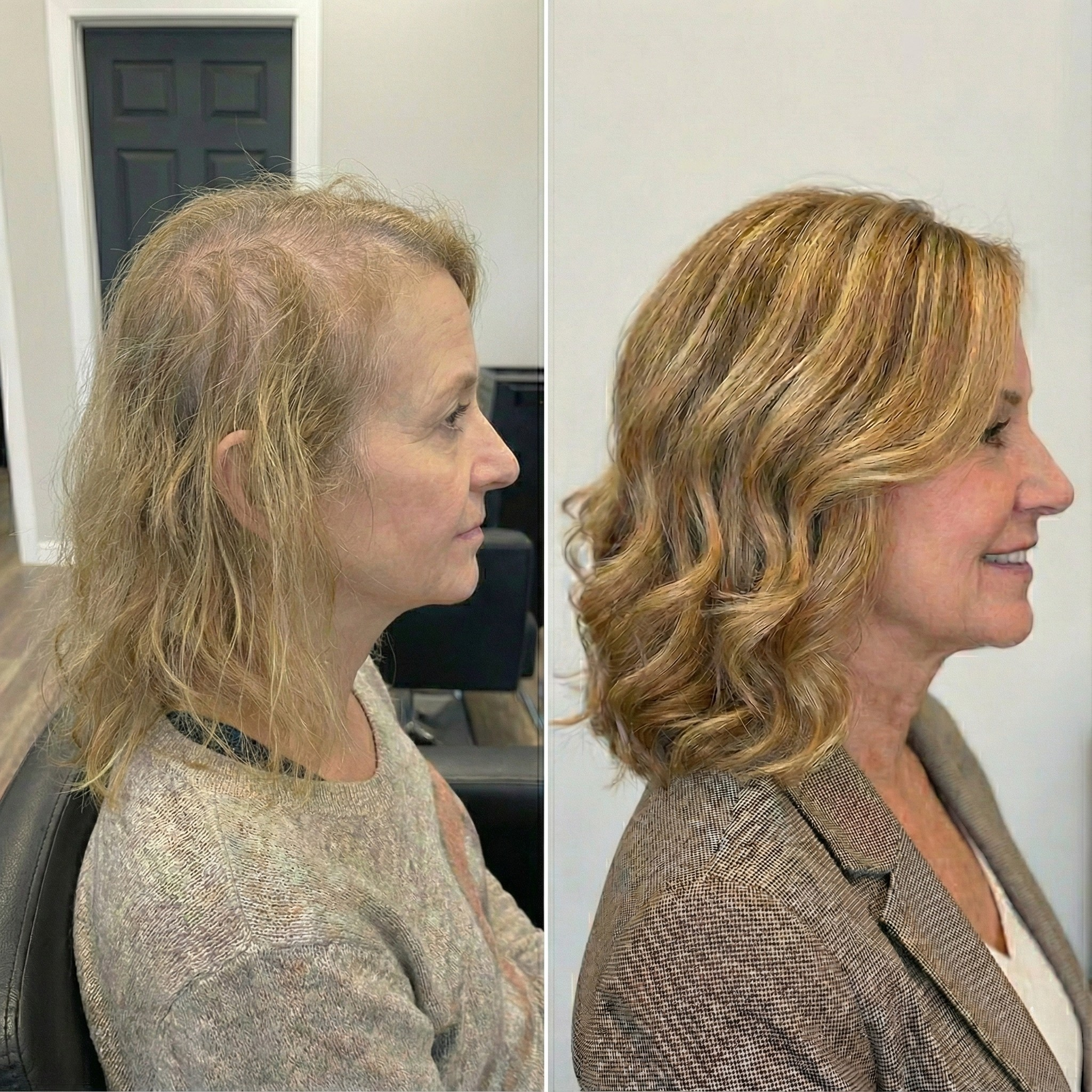 Metia - Follicle Revival Serum